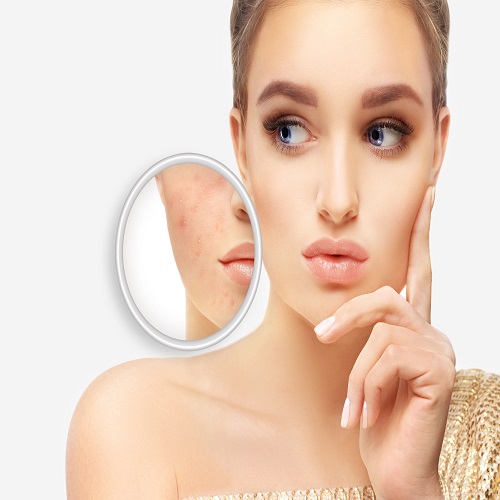 Image for Image Perfect Laser with ID of: 5479966