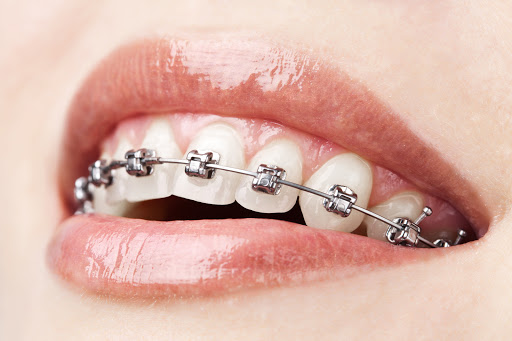 Image for Calismile Orthodontics with ID of: 5485378