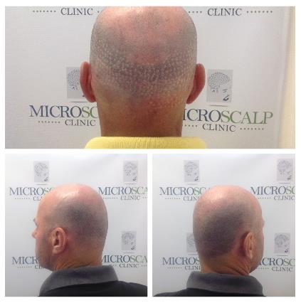 Image for Micro Scalp Clinic with ID of: 5493468
