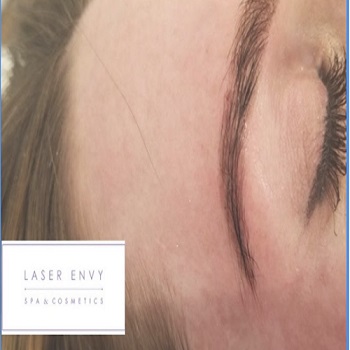 Image for Laser Envy Spa with ID of: 5500805