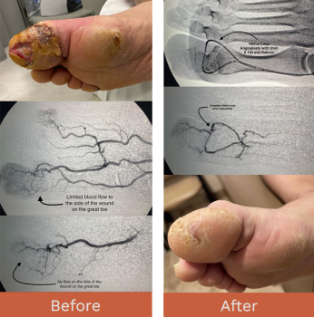 Image for AVA Vascular with ID of: 5506709