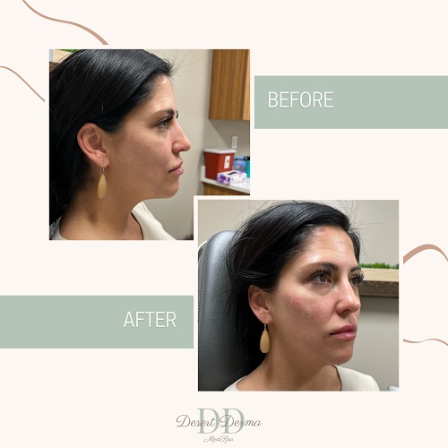 Image for Desert Derma MedSpa with ID of: 5554000