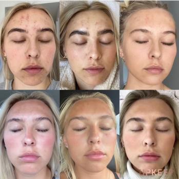 Image for UPKEEP with ID of: 5576343
