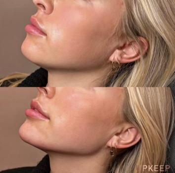 Image for UPKEEP with ID of: 5576347