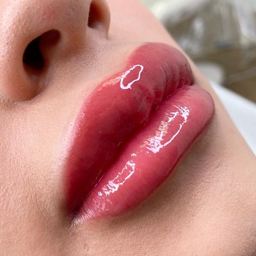 Image for Lisa OM with ID of: 5580493
