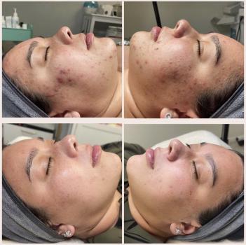 Image for MOOD Skin & Body with ID of: 5590013