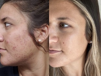 Image for Skinsations Aesthetics with ID of: 5590147