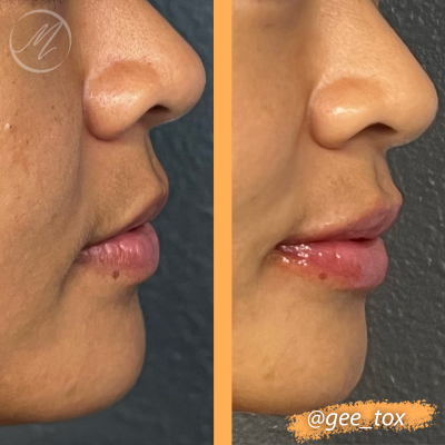 Image for Montecito Med Spa with ID of: 5592749
