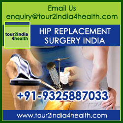 Image for Affordable Hip Replacement in India with ID of: 6433856