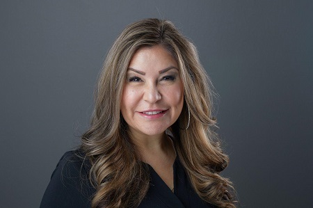Image for Amy Vigil - Lip Filler with ID of: 5646646