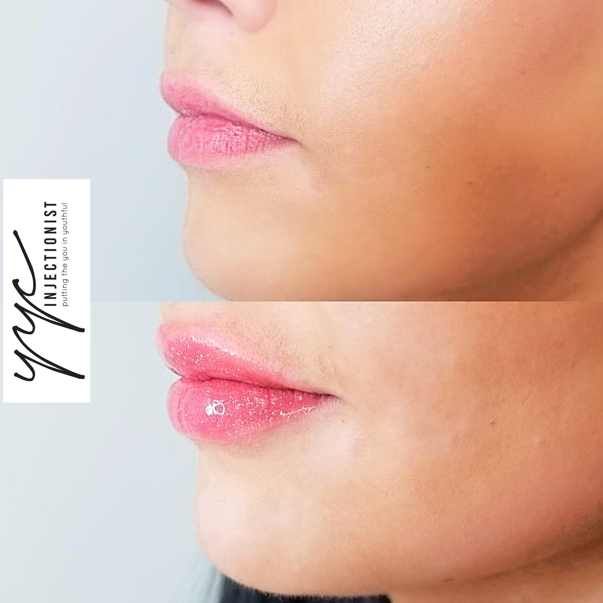 Image for The Injectionist & Aesthetics with ID of: 5672591