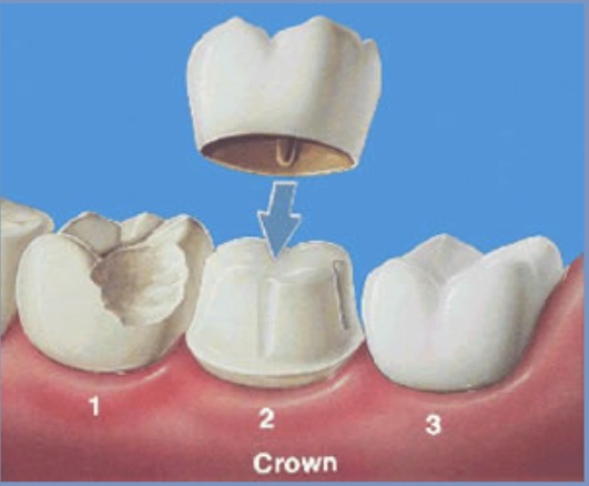 Image for Beachwood Dental with ID of: 5685766