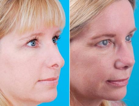 Image for Becker Plastic Surgery with ID of: 5705606
