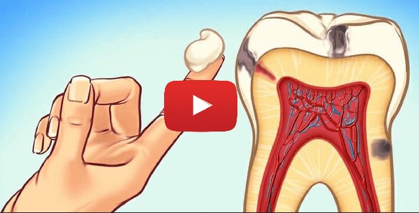 Image for Flossing Your Way to Health: How Regular Dental Care Can Prevent Gum Disease with ID of: 6490414