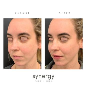 Image for Synergy Face + Body | Plastic Surgery with ID of: 5707417