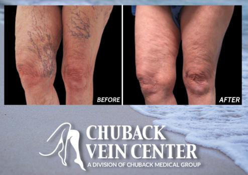Image for Chuback Vein Center with ID of: 5710676