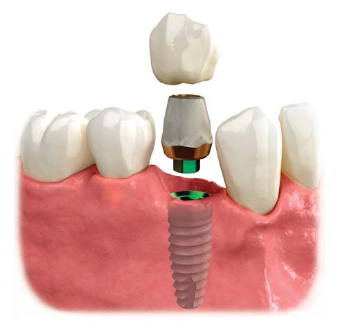 Image for Promenade Dental Care with ID of: 5712421