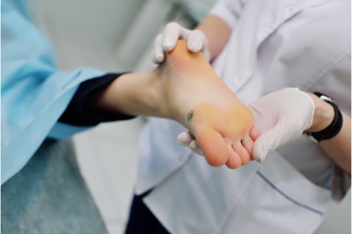 Image for LA Foot Laser with ID of: 5719605