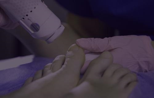 Image for LA Foot Laser with ID of: 5719614