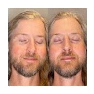 Image for Torstveit Medical Aesthetics with ID of: 5720925