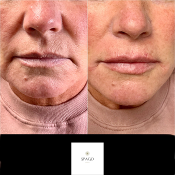 Image for SpaGo MedSpa with ID of: 5748421