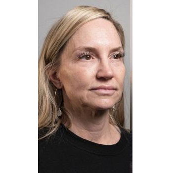 Image for Skin! Medical Aesthetics with ID of: 5749820