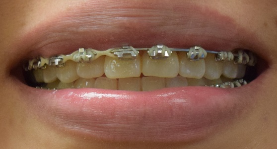 Image for Pagosa Smiles with ID of: 5751451