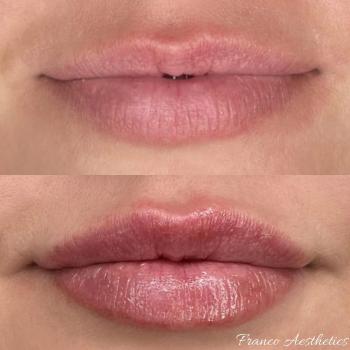 Image for Franco Aesthetics with ID of: 5762344