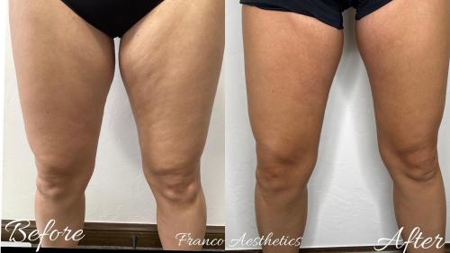 Image for Franco Aesthetics with ID of: 5762346