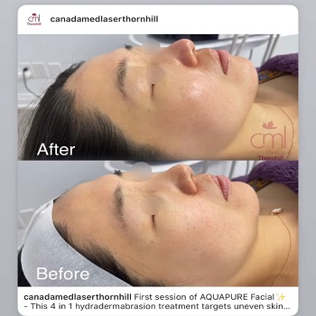 Image for Canada MedLaser Thornhill with ID of: 5765928