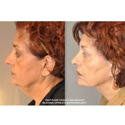 Image for Dr. William Numa - Plastic Surgeon with ID of: 5772528