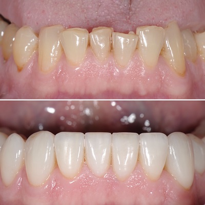 Image for Phelan Dental with ID of: 5791747