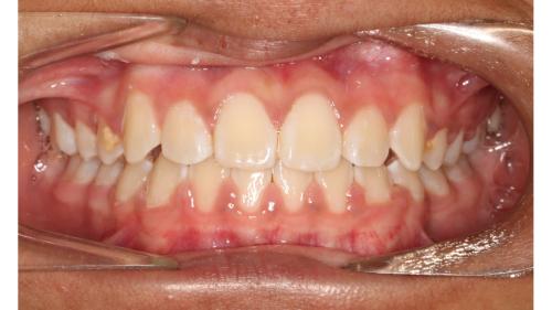 Image for Braces N Faces Orthodontics with ID of: 5829674
