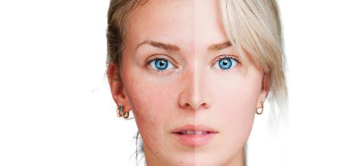 Image for Lebo Skin Care- Hanover with ID of: 5837009