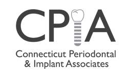 Image for CT Perio Implants with ID of: 653519