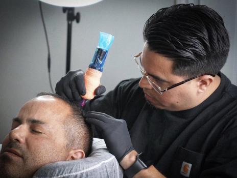 Image for Precision First SMP | Los Angeles Scalp Micropigmentation with ID of: 5895382