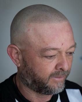 Image for Precision First SMP | Los Angeles Scalp Micropigmentation with ID of: 5895383