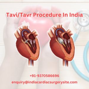 Image for Cost of Trans Catheter Aortic Valve Replacement (Tavr) India with ID of: 6583285