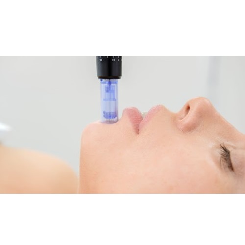 Image for Canada MedLaser with ID of: 5958738