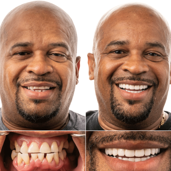 Image for JAX Dental Implants & Dentures with ID of: 5974337