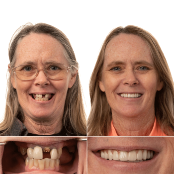 Image for JAX Dental Implants & Dentures with ID of: 5974338