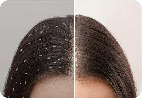 Image for Premier Lice Spa with ID of: 5988717