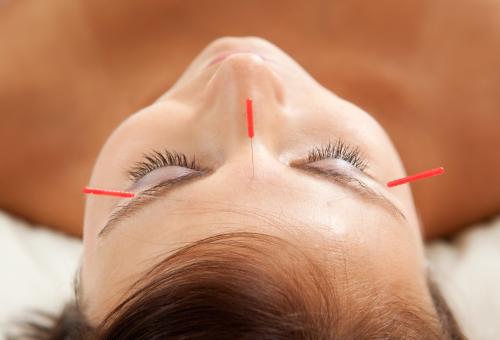 Image for AT Pain Solutions Acupuncture Clinic with ID of: 6009825
