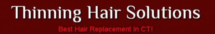 Image for Thinning Hair Solutions with ID of: 661720