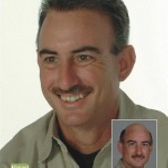 Image for Thinning Hair Solutions with ID of: 661723