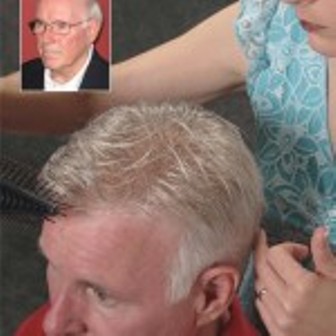 Image for Thinning Hair Solutions with ID of: 661725
