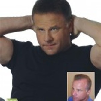 Image for Thinning Hair Solutions with ID of: 661727