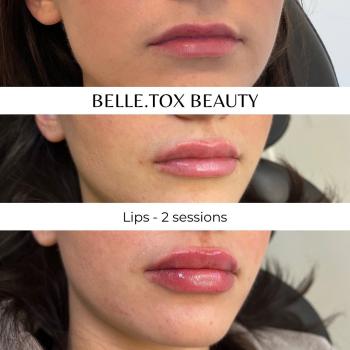 Image for Belle.tox Beauty with ID of: 6041743