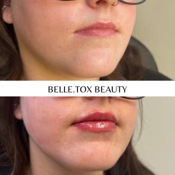 Image for Belle.tox Beauty with ID of: 6041745