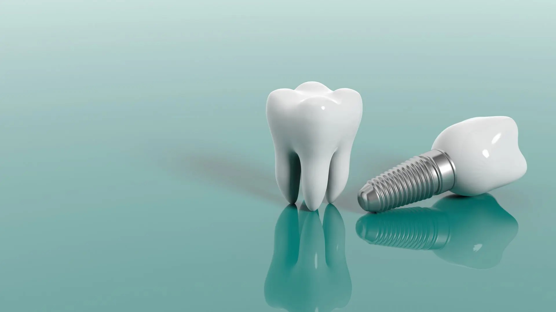 Image for 7 Considerations Before Getting Dental Implants with ID of: 6631608